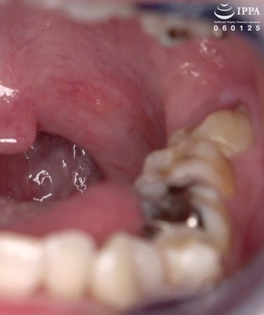 千石もなか出演番号AD-1536磁力链接迅雷下载在线观看