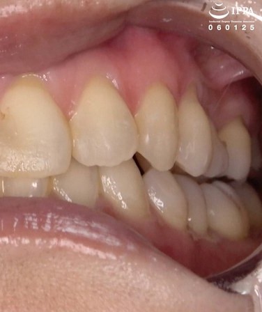 出演番号AD-1840磁力链接迅雷下载在线观看