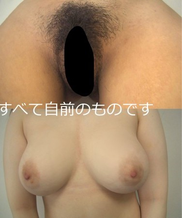 出演番号GSANPINE-001磁力链接迅雷下载在线观看